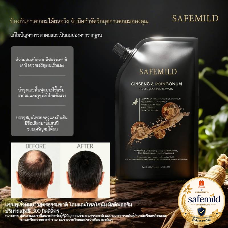 【ของแท้จากร้านออฟฟิเชียล】SAFEMILD herbalแชมพูป้องกันผมร่วงช่วยบรรเทาอาการคันหนังศีรษะและลดปัญหาผมบางได้อย่างมีประสิทธิภา