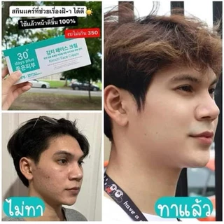 Kimchi Face Cream ครีม กิมจิ เฟสครีม 30 เดย์ พลัส / Good skin แบรนด์ ครีมกิมจิ ครีมกำจัดฝ้า กระ