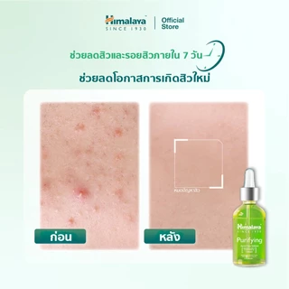 Himalaya Purifying Neem Face Serum 15ml