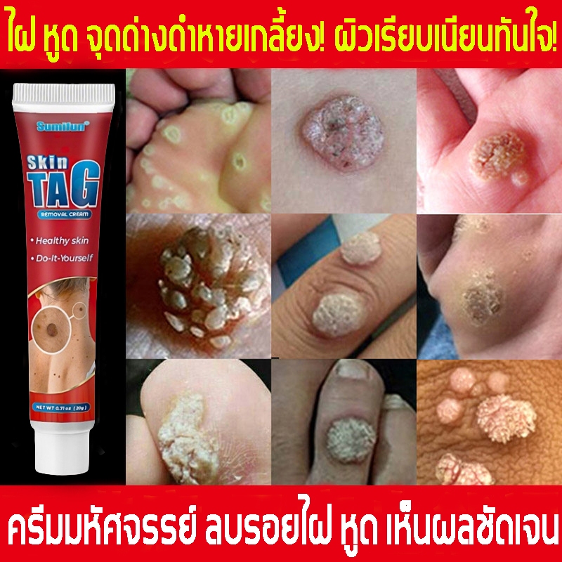 ครีมบำรุงผิว ผิวอ่อนโยน ปลอดภัย ส่วนผสมสมุนไพร ดูแลผิวอย่างอ่อนโยน ใช้งานสะดวก เหมาะสำหรับผิวเสียหายและผิวบอบบาง
