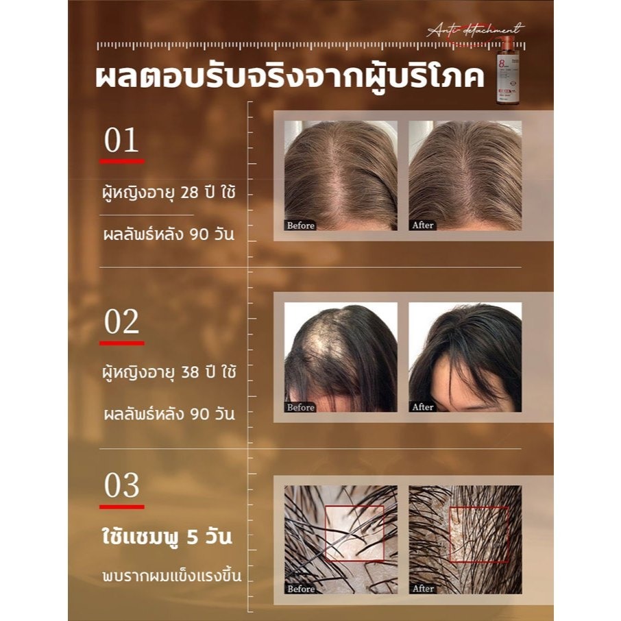 แชมพูสมุนไพรธรรมชาติของแท้ 500ml ทำความสะอาดหนังศีรษะลึก รูปที่ 4