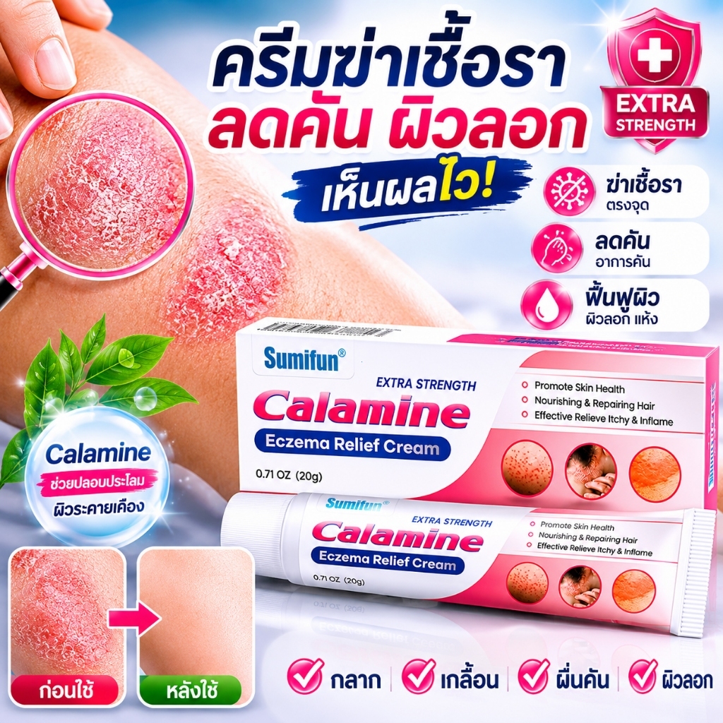 1 ครั้งเห็นผล ครีมลดอาการคัน สะเก็ดเงินครีม โรคผิวหนัง เกลื้อน กลาก คัน สมุนไพร แก้คันเรื้อรัง คันในร่มผ้า