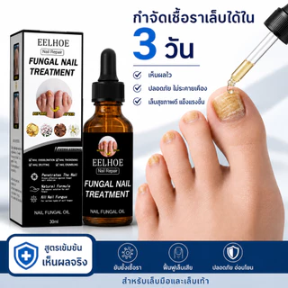 EELHOE เซรั่มซ่อมแซมเล็บ ซ่อมแซมเล็บเสีย ดูแลปัญหาเชื้อราที่เล็บ ใช้ได้ทั้งเล็บมือและเล็บเท้า ช่วยให้เล็บแข็งแรงขึ้น