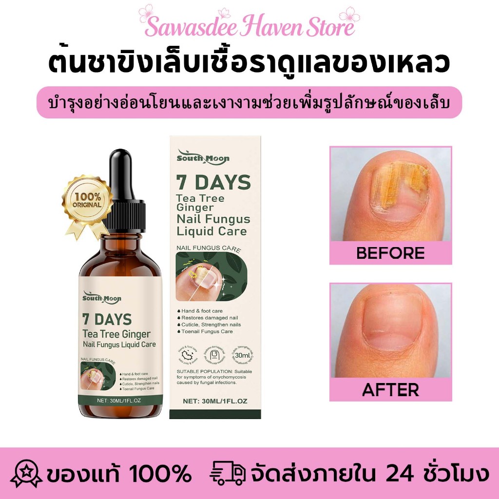 South Moon เซรั่มซ่อมแซมเล็บ น้ำยาบำรุงเล็บ น้ำมันบำรุงรักษาเชื้อราที่เล็บ บำรุง ทำให้เล็บขาวสว่าง ซ่อมแซมสุขภาพของเล็บ