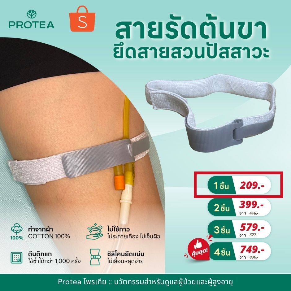 สายรัดต้นขายึดสายสวนปัสสาวะโพรเทีย