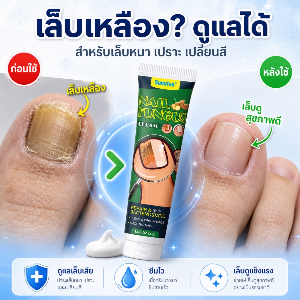 เล็บกลับมาดูปกติใน 3 วัน เซรั่มบำรุงเล็บ ดูแลปัญหาเล็บจากเชื้อรา เล็บเหลือง เล็บหนา เล็บเปราะ ให้เล็บดูสุขภาพดีขึ้น