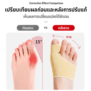 ถุงเท้าสวมนิ้วโป้งเสริมแผ่นเจล ซิลิโคนที่ด้านข้างนิ้วโป้งเท้า ป้องกันเสียดสี แก้กระดูกผิดรูป เอียง คด งอ เพื่อสุขภาพ