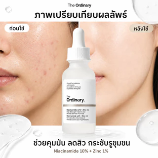 The Ordinary Niacinamide 10% + Zinc 1% เซรั่มบำรุงผิวมัน สิว รูขุมขนกว้าง ผิวหมองคล้ำ 30ml ของแท้