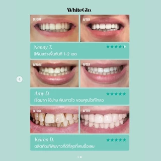 WhiteGlo Professional White Whitening (Peak's Pick) ยาสีฟันสูตรโปรไวท์ ปรับฟันขาวจากออสเตรเลีย