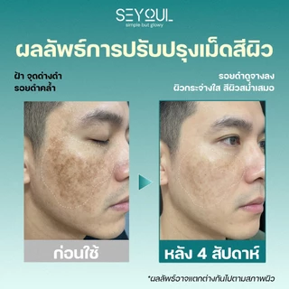 Advanced Youth Activating Serum Seyoul เอสเซ้นส์บำรุงผิว กระ จุดด่างดำ เติมความชุ่มชื้น ฟื้นฟูผิว 50ml