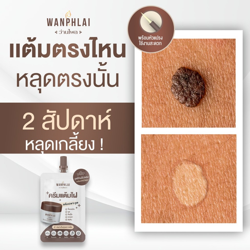 [ของแท้] ครีมแต้มไฝ ว่านไพล ขี้แมลงวัน ติ่งเนื้อ หูด ตาปลา แก้ปัญหา สิวหิน ครีมกำจัดไฝว่านไพล ไฝ จี้ตาปลา ขนาด 1.2 กรัม
