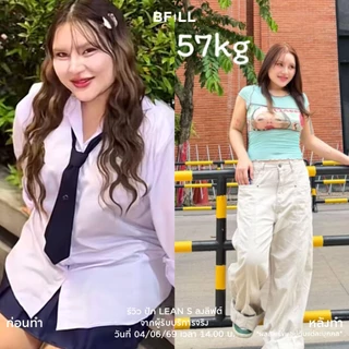 BFiLL โปรแกรม Lean S (Mounja) ปักตะกร้า ลงลิฟต์ คุมหิว คุมน้ำหนัก ลดสัดส่วน ลดไขมัน ดูแลรูปร่างโดยแพทย์ ไม่ต้องผ่าตัด