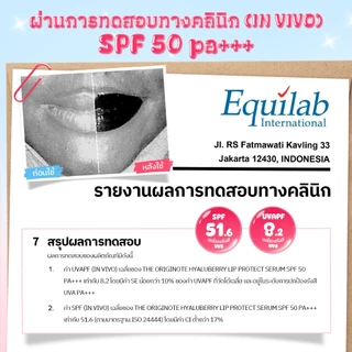 【New launch】The Originote Hyaluberry Lip Serum & Lip Glaze SPF 50 PA+++ ปกป้องริมฝีปากจาก UVA/UVB