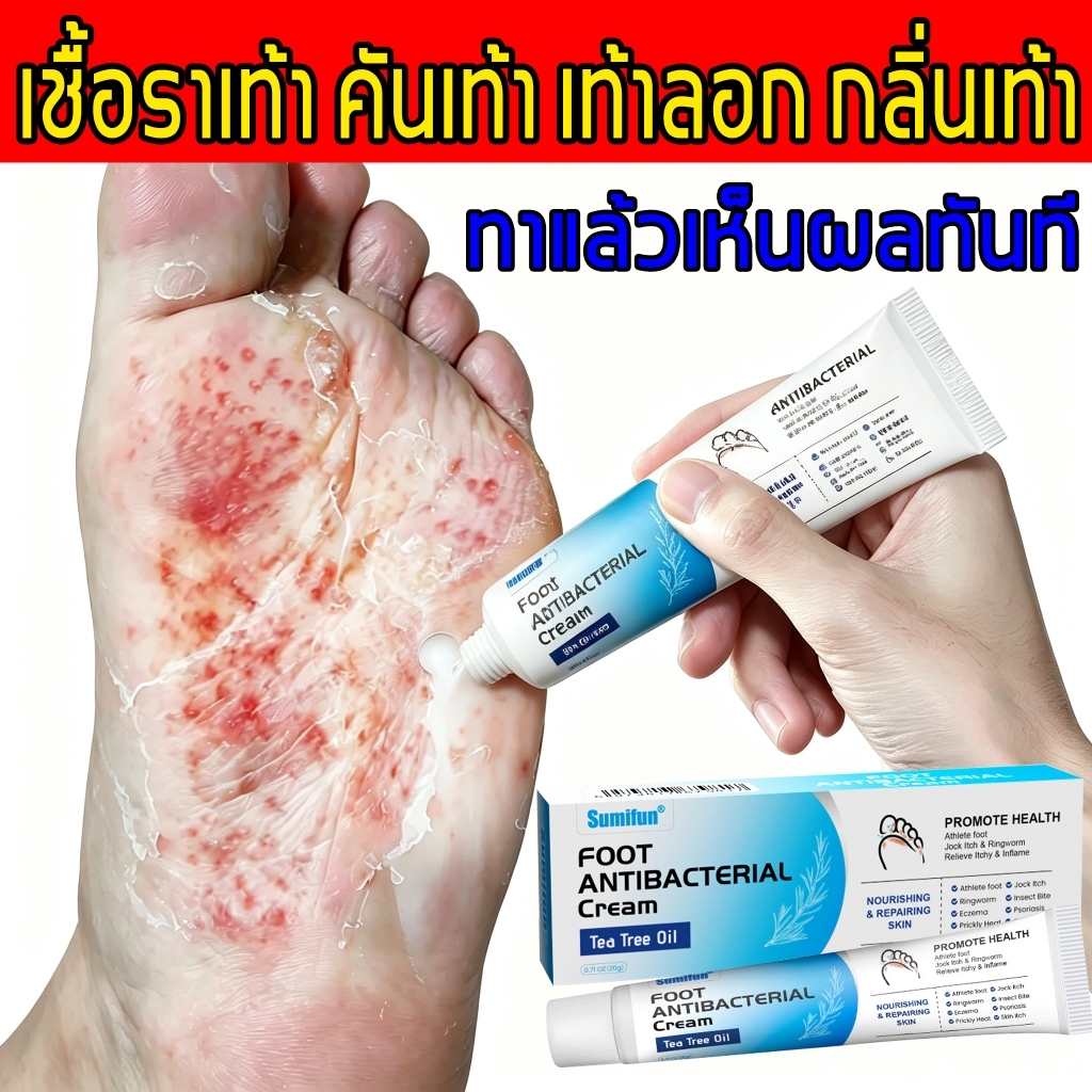 ครีมทาเท้า รักษาเชื้อราที่เท้า บรรเทาอาการคัน ความแห้ง ผิวลอก ตุ่มน้ำ ส่วนผสมอ่อนโยน ใช้งานง่าย ลดกลิ่นเท้า