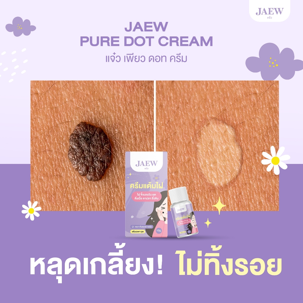 [ของแท้] ครีมไฝแจ๋ว ขี้แมลงวัน ติ่งเนื้อ หูด ตาปลา แก้ปัญหา กระ สิวหิน ครีมแต้มไฝแจ๋ว ไฝ หูด จี้ไฝ แต้มไฝ - รูปที่ 6