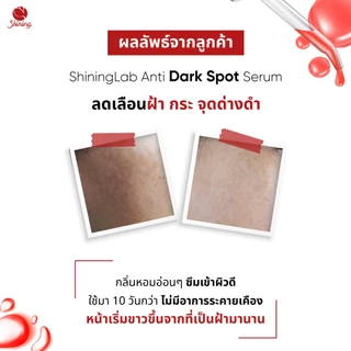 เซรั่มลดฝ้า กระ จุดด่างดำ ผิวหมองคล้ำ Shininglab Anti Dark Spot 15ml ร้านเจ้าของแบรนด์ Shining (ของแท้ 100%)