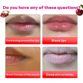 ลดริมฝีปากคล้ำ แก้ดำโดยไม่เด้ง ครีมทาปากชมพู นำเข้าเดิม Lip Sleeping Mask Berry Lip Treatment 20g ลิปมาส์ก ลิปบาล์ม คงคว