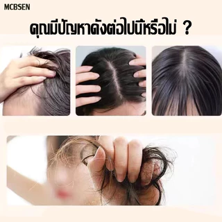 สเปรย์ปลูกผม 100ml เร่งผมขึ้นใหม่ ปลูกผมเร่งด่วน เซรั่มปลูกผมดก เซรั่มบำรุงผม สเปย์ปลูกผม สเปรย์ปลูกผมดก