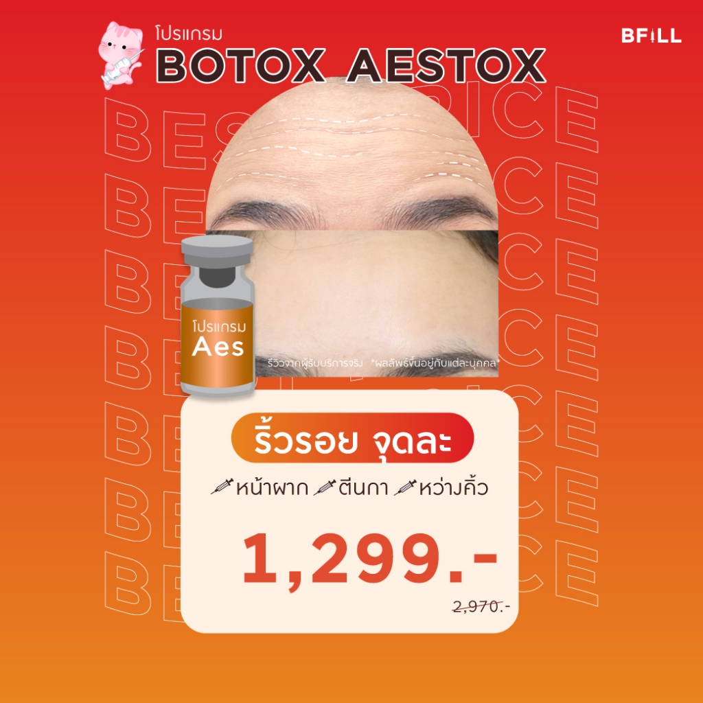 โปรแกรม Botox (Aestox) Wrinkles โบท็อก ริ้วรอย ตีนกา หว่างคิ้ว ริ้วรอยหน้าผาก โบปีกจมูก