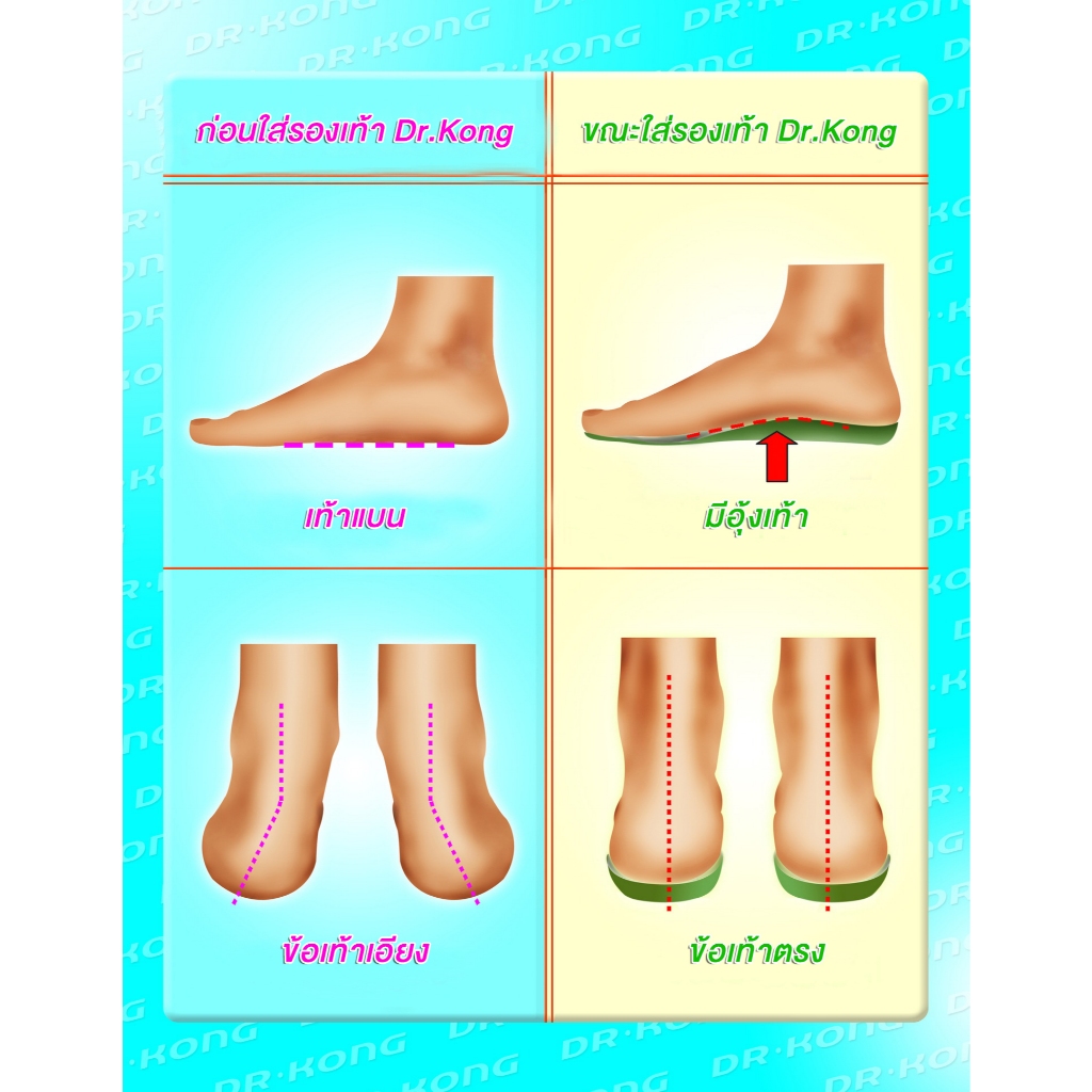 Dr.Kong Healthy Shoes รองเท้าสุขภาพรุ่น C65079E3 รองเท้าผ้าใบนักเรียน - รูปที่ 7