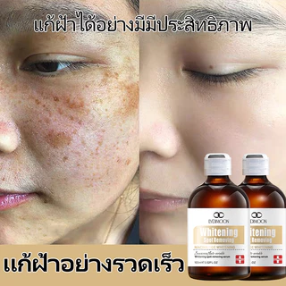 เซรั่มลดฝ้า กระ จุดด่างดํา เซรั่มลดฝ้า เซรั่มฝ้า 100ml กำจัดฝ้า จุดด่างดำ กระ ฝ้า ลบเมลานิน กระจ่างใสผิว แก้ฝ้าทุกชนิด