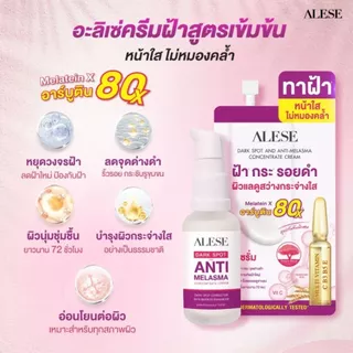 (โปรเดือน 8.8.) ALESE Dark Spot And Melasma Concentrate Cream 30 g ครีมเนื้อเซรั่มสูตรเข้มข้น ดูเเลฝ้า รอยดำรอยเเดงดูจ