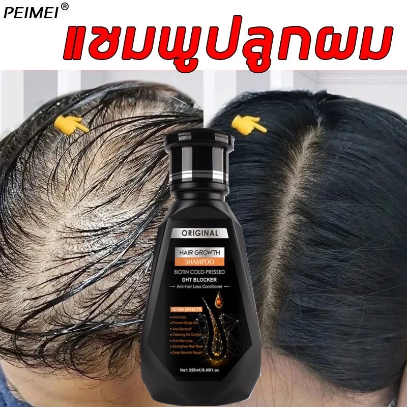 PEIMEI แชมพูแก้ผมร่วง แชมพูสมุนไพร แชมพูปลูกผม 250ml แชมพูปลูกผม แชมพูปลูกผมดก ยาสระผมเร่งผมยาว แชมพูขิง แชมพูบำรุงผม