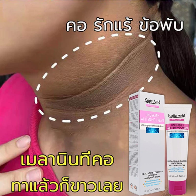 Kojic Acid ครีมขาหนีบดำ 50ml ครีมทารักแร้ขาว ครีมบำรุงรักแร้ เข่าดำ ผิวขาว สิ่งประดิษฐ์ ครีมขาหนีบดำ