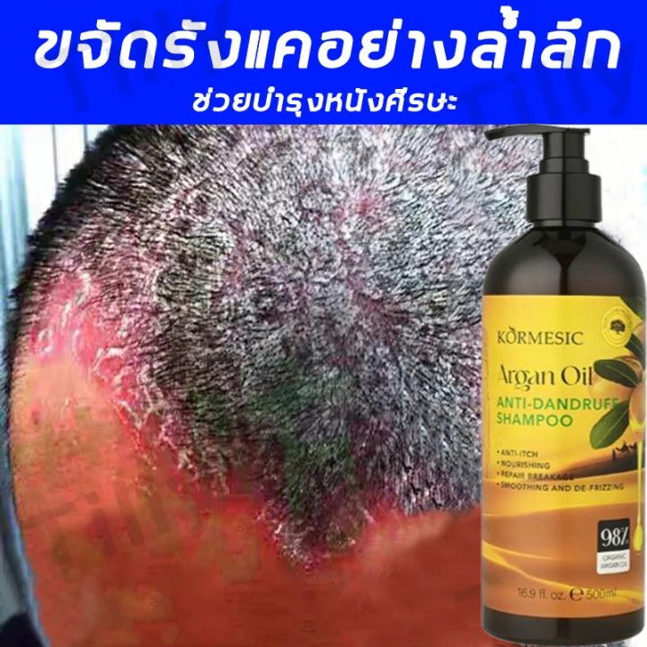 แชมพูรังแค แชมพูคัน แชมพูยาเชื้อรา 500ml แชมพูแก้คันหนังศรีษะ ขจัดรังแค หยุดอาการคัน ลดผมร่วง ยาสระผมขจัดรังแค