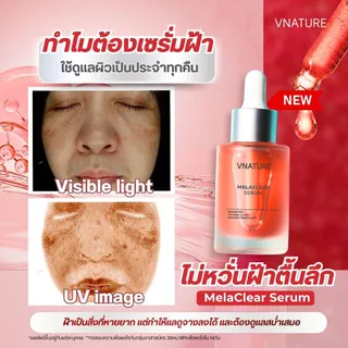 เซรั่มฝ้า Melaclear Serum Vnature วีเนเชอร์ เซรั่มฝ้ากระ จุดด่างดำ ผิวแพ้ง่าย หน้าใส 30ml.