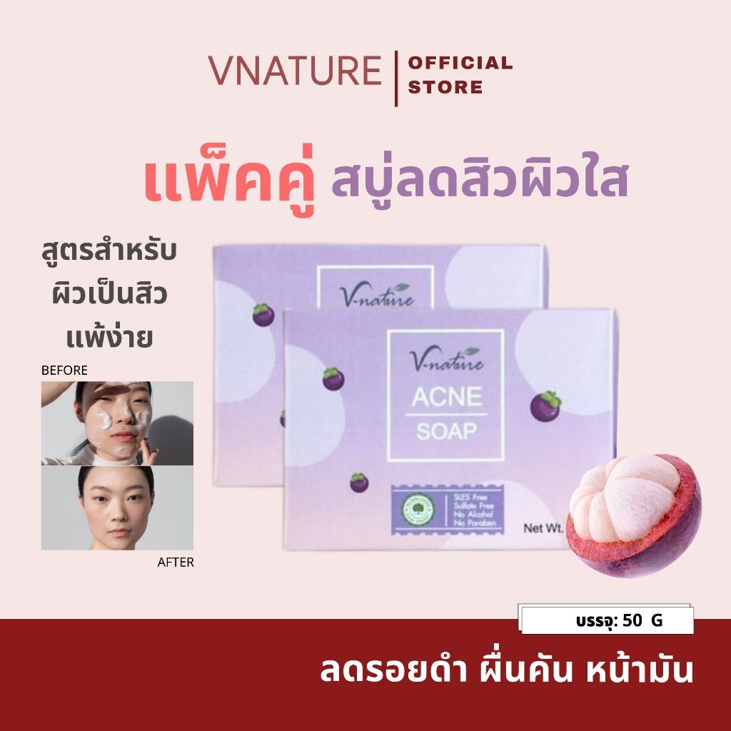 สบู่ลดสิว รอยสิว VNATURE Pimple&Whitening Soap สิวอุดตัน สิวอักเสบ ลดสิวผด สิวหลัง สบู่แก้สิว ผิวใส