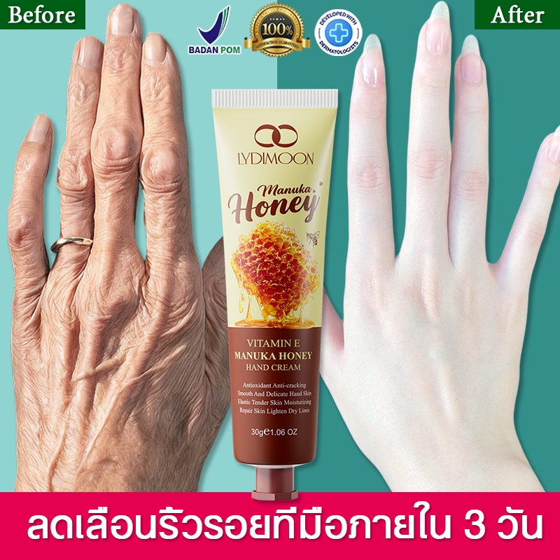 LYDIMOON ครีมทามือวิตามินอีมานูก้าฮันนี่ 30g สกัดจากธรรมชาติ บำรุงมือแห้งแตก เพิ่มความกระจ่างใสและเร