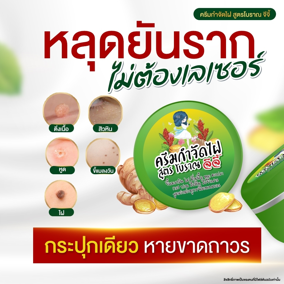 ครีมไฝจีจี้ ขี้แมลงวัน ติ่งเนื้อ หูด ตาปลา แก้ปัญหา กระ สิวหิน ครีมแต้มไฝจีจี้ไฝ หูด จี้ไฝ แต้มไฝ หูดติ่งเนื้อ