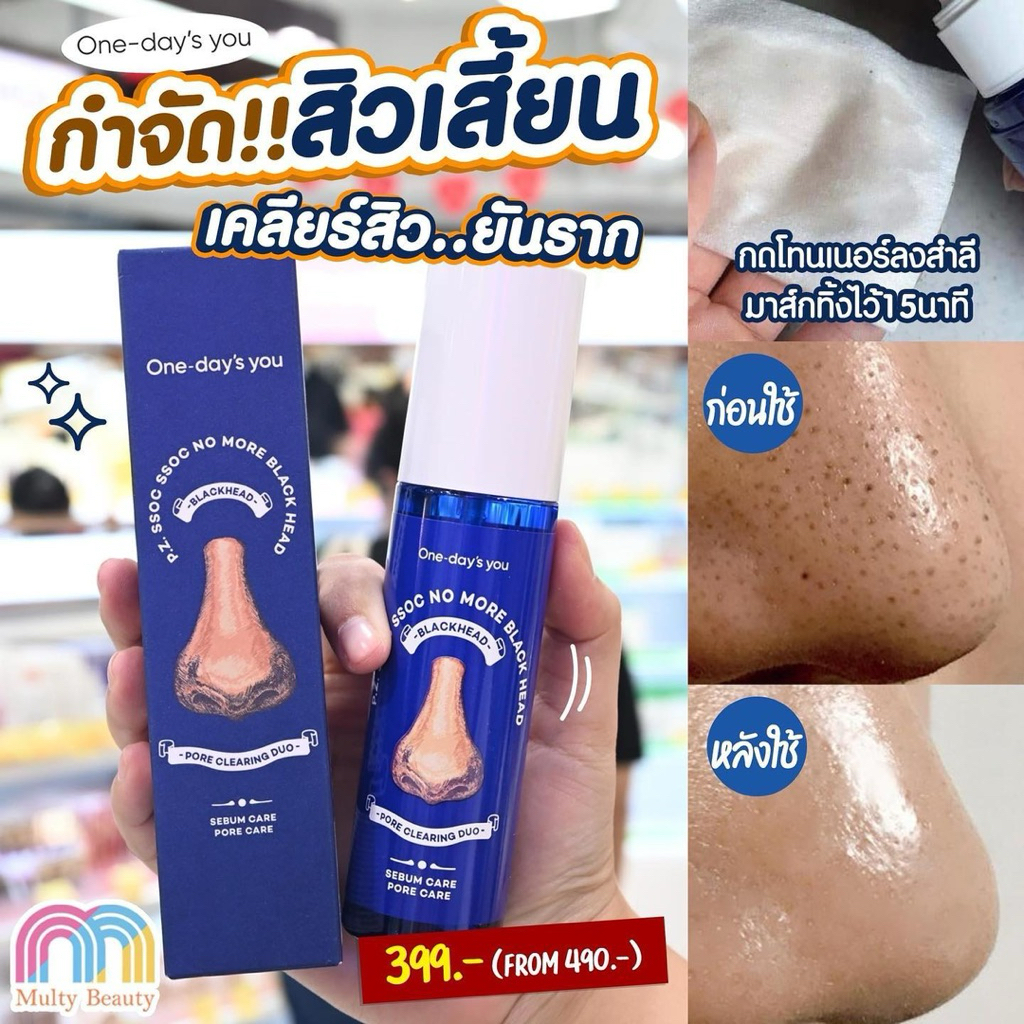 ( Clearance )โทนเนอร์กำจัดสิวเสี้ยนสิวหัวดำ One-Day's you