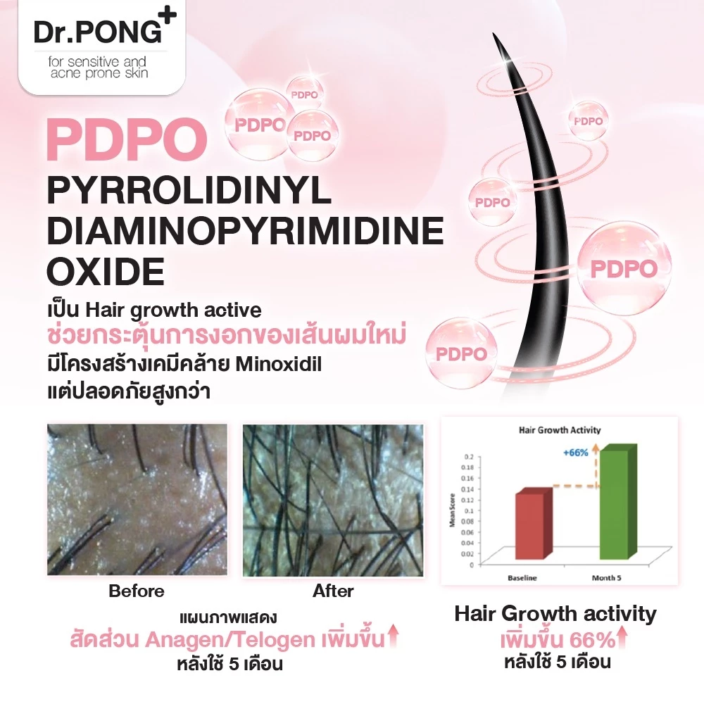 Dr.PONG TSUTSUJI GENTLE SHAMPOO แชมพูลดผมร่วง anti-hairloss shampoo ขนาด 200ml thumbnail 6