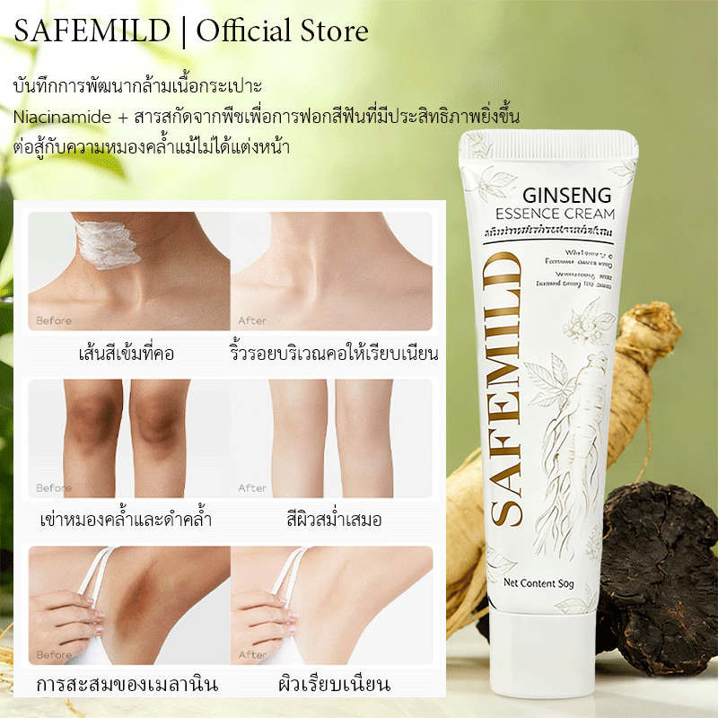 【ไวท์เทนนิ่งสำหรับผู้หญิง】SAFEMILD ครีมไวท์เทนนิ่งลบริ้วรอย ครีมขาหนีบดำ ครีมหัวนมชมพู ทาที่ลับขาว ลบเมลานิน