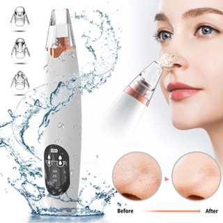 เครื่องดูดสิวเสี้ยน 💆 ปรับ 3 ระดับ+แถมฟรีหัวดูด 3 ✨ ชาร์จ US…