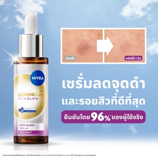 [สินค้าขายดี]นีเวีย ลูมินัส630 สกิน โกลว์ เซรั่ม เซรั่มผิวใส เซรั่มทาหน้า30 มล.2 ชิ้นNIVEA