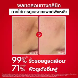 วิชี่ Vichy Liftactiv Collagen Specialist 16 Bonding Serum เซรั่มบำรุงผิวหน้า จัดการสัญญาณแห่งวัย 16 ประการ*