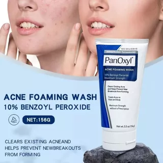 PanOxyl Acne Bar พร้อม 10% Benzoyl Peroxide ทำความสะอาดผิว รักษาสิว หัวดำ หัวขาว ปรับสมดุล pH