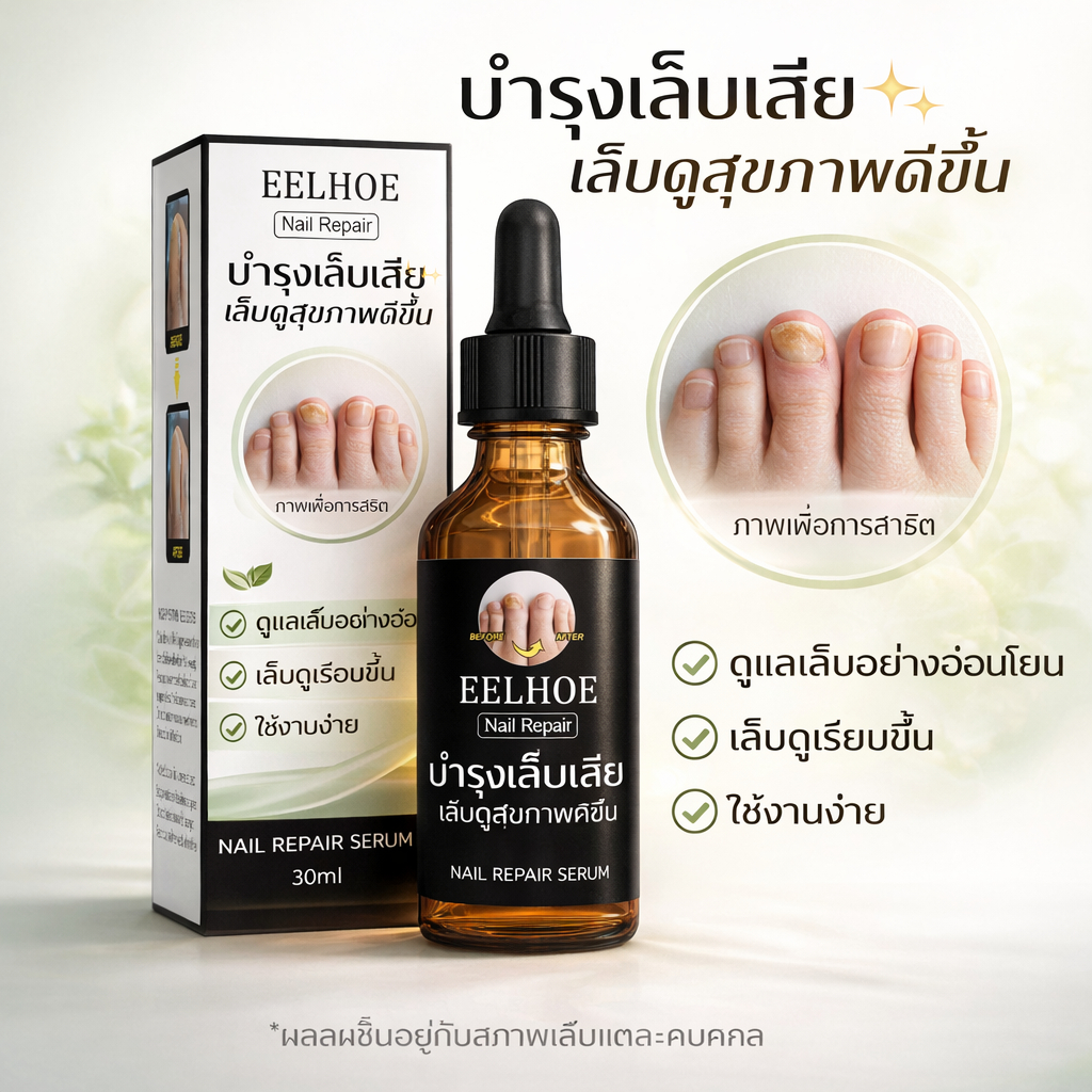 เซรั่มบำรุงเล็บ EELHOE รักษาเชื้อราเล็บ รักษาเล็บขบ ฆ่าเชื้อราที่เล็บ น้ำยาบำรุงเล็บ เชื้อราที่เล็บ