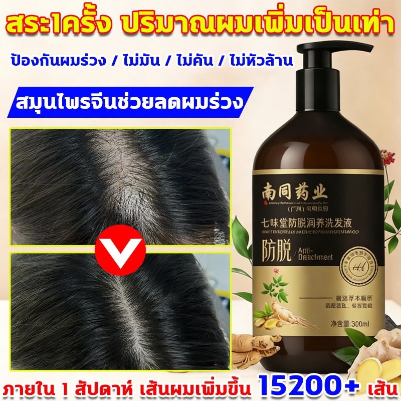 แชมพูป้องกันผมร่วง สระ1ครั้ง ปริมาณผมเพิ่มเป็นเท่า แชมพูปลูกผม แชมพูขิง สมุนไพรจีนช่วยลดผมร่วง แชมพูแก้ผมร่วง