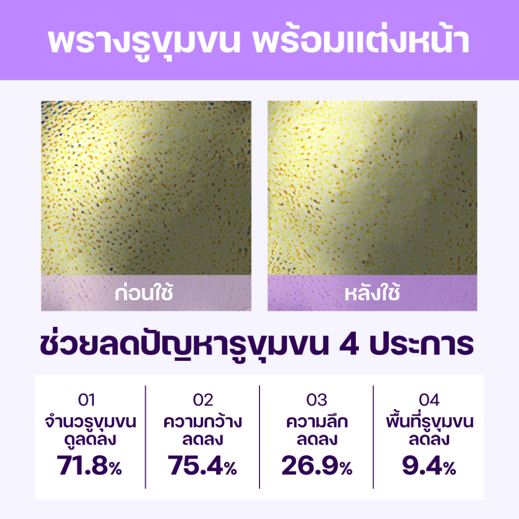 [Gift] DR.G Pore Blur Up sun 20ml [สินค้าสมนาคุณงดจำหน่าย] - รูปที่ 3