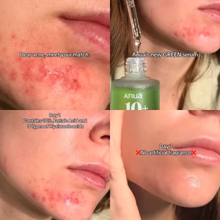 รวมเซรั่ม Azelaic Acid 10 Hyaluron/ PDRN Hyaluronic Acid Capsule 100/ Niacinamide 10% + TXA 4%
