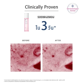 [สูตรใหม่!] d program ดี โปรแกรม มอยส์เจอไรซิ่ง แคร์ โลชั่น 125 mL