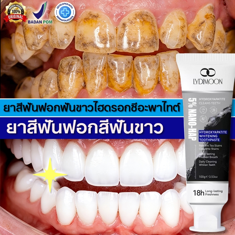 LYDIMOON ยาสีฟันซ่อมแซมด้วยนาโนไฮดรอกซีอะพาไทต์ 5% ยาสีฟันฟันขาว 100g ฟอกสีฟันขาว ขจัดคราบหินปูน ลดก