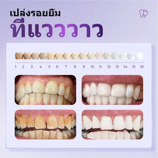 【ซื้อ 1 แถม 1】YOOMU ยาสีฟันสีม่วง ฟอกฟันขาว 50g ลดคราบเหลือง ไฮดรอกซีอะพาไทต์ ลดเสียวฟัน ลดกลิ่นปาก