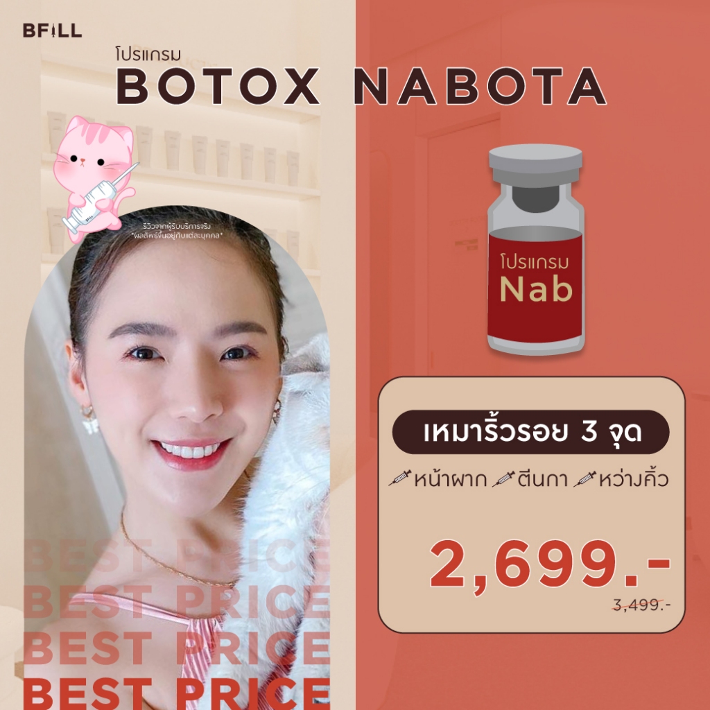 โปรแกรม Botox (Nabota) Wrinkles or Jawline or Face Lift / ริ้วรอย หรือ กราม หรือ ลิฟหน้า
