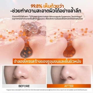 【New】PAPA FEEL [FDA] HPR Retinol Peptide Renewal Cleanser 80ml ผิวมัน ผิวหยาบ ผิวหมองคล้ำ ริ้วรอย สิว สิวหัวดำ
