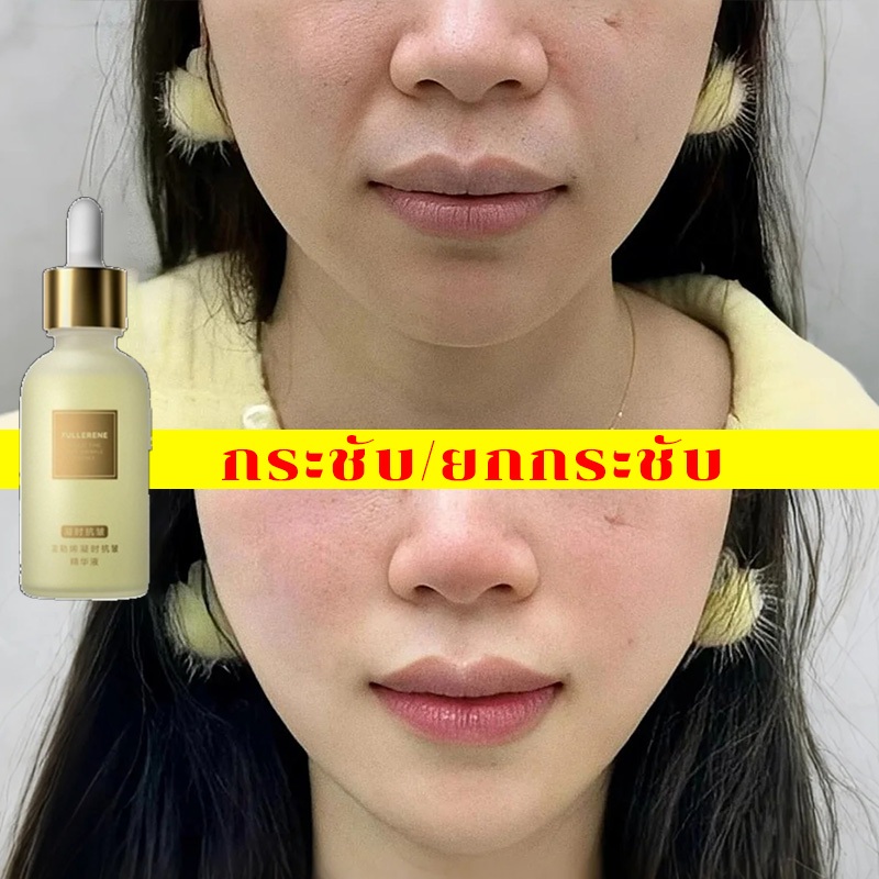 กระชับ/ยกกระชับ เซรั่มหน้าใส ครีมต่อต้านริ้วรอย รอยตีนกา ริ้วรอยหน้าผาก ริ้วรอยหน้า เผยผิวหน้าที่ กระชับผิว